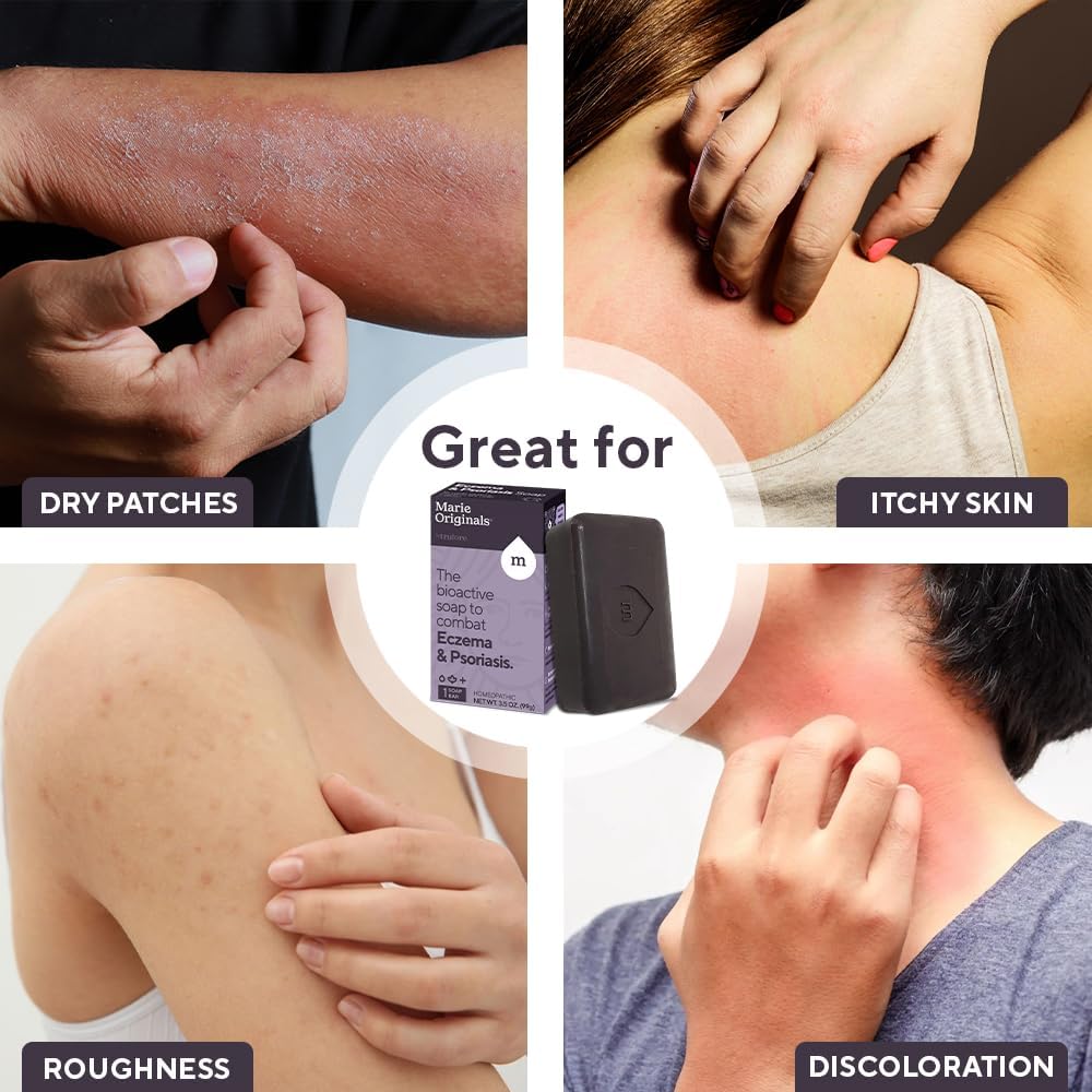 all-natural-eczema-face-and-body-soap-bar-for-dry-itchy-skin-relief---gentle-psoriasis-and-dermatitis-treatment---detoxifying-healing-anti-itch-cleanser---single-pack-4