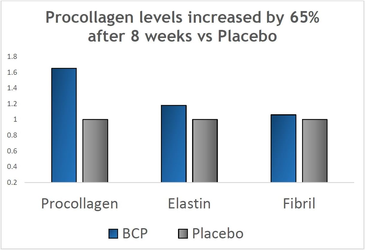 2 Month Supply of BESHA INC Verisol Collagen Bioactive Peptides, Natural Collagen Powder from Germany - Espot.com.au