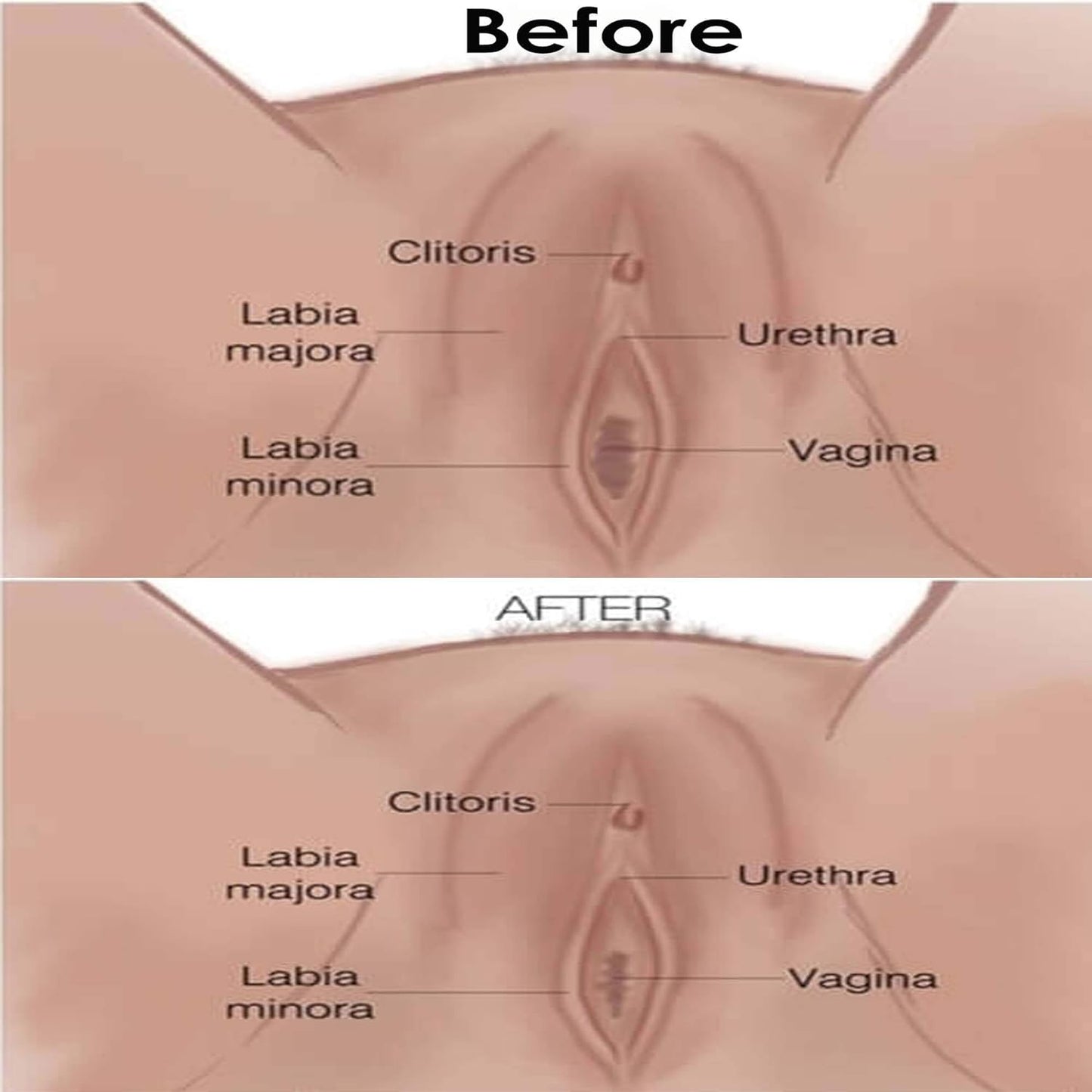 arunkriss-herbs-vagina-tightening-feminine-steam-cleansing---herbal-blend-for-firming-and-repair-in-women-5-steams-2