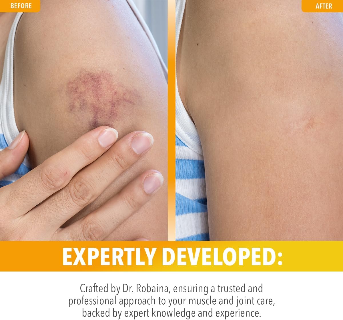 natural-arnica-bruise-relief-roll-on---fast-swelling-and-bruise-relief-3-oz-bottle-4
