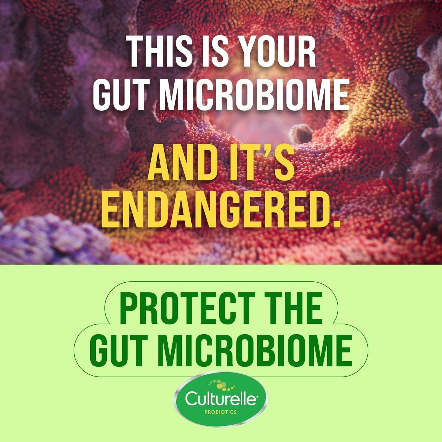 culturelle-daily-probiotic-for-gut-health---abdominal-support-comfort---helps-with-bloating-and-gas---28-count-pack---proactive-gut-health-solution-6