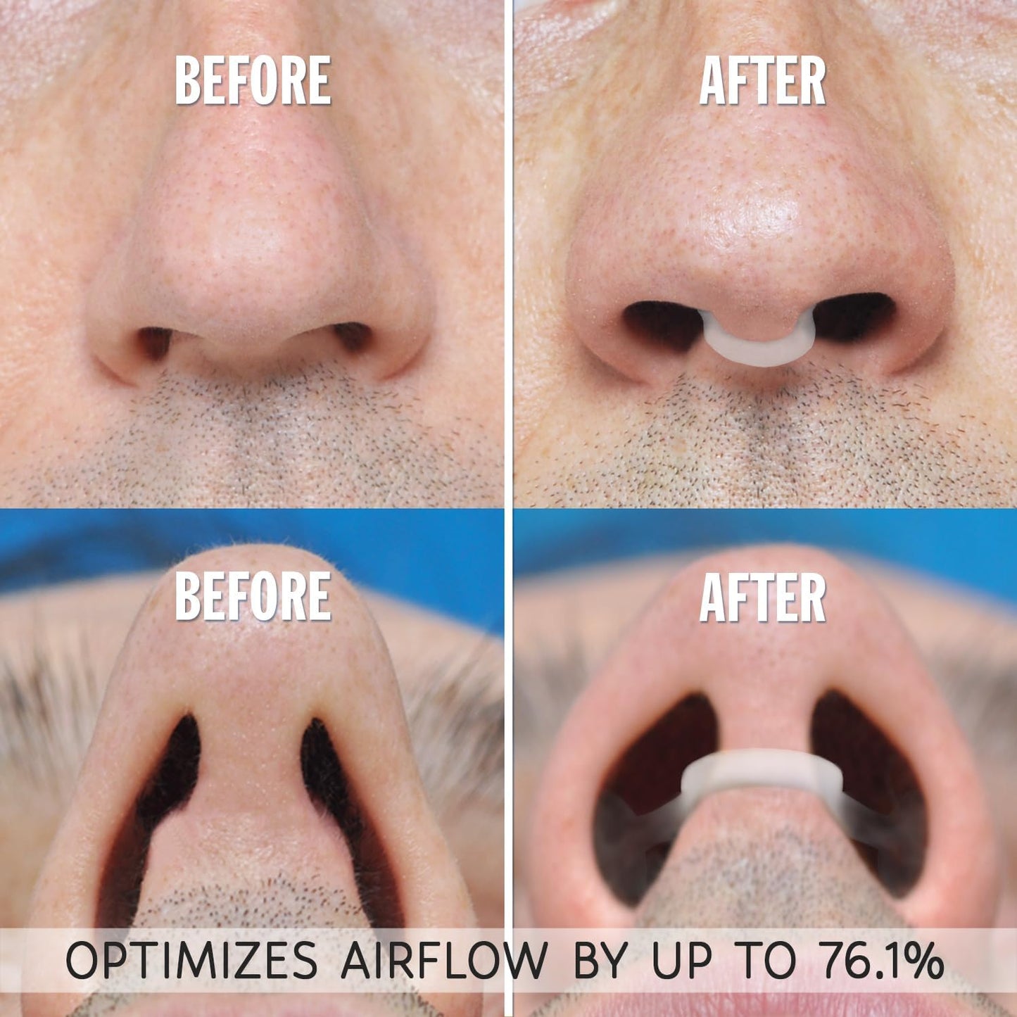 airmax-nasal-dilator---natural-anti-snoring-device-for-better-sleep-smallmedium-sizes-comfortable-and-effective-breathing-solution-4