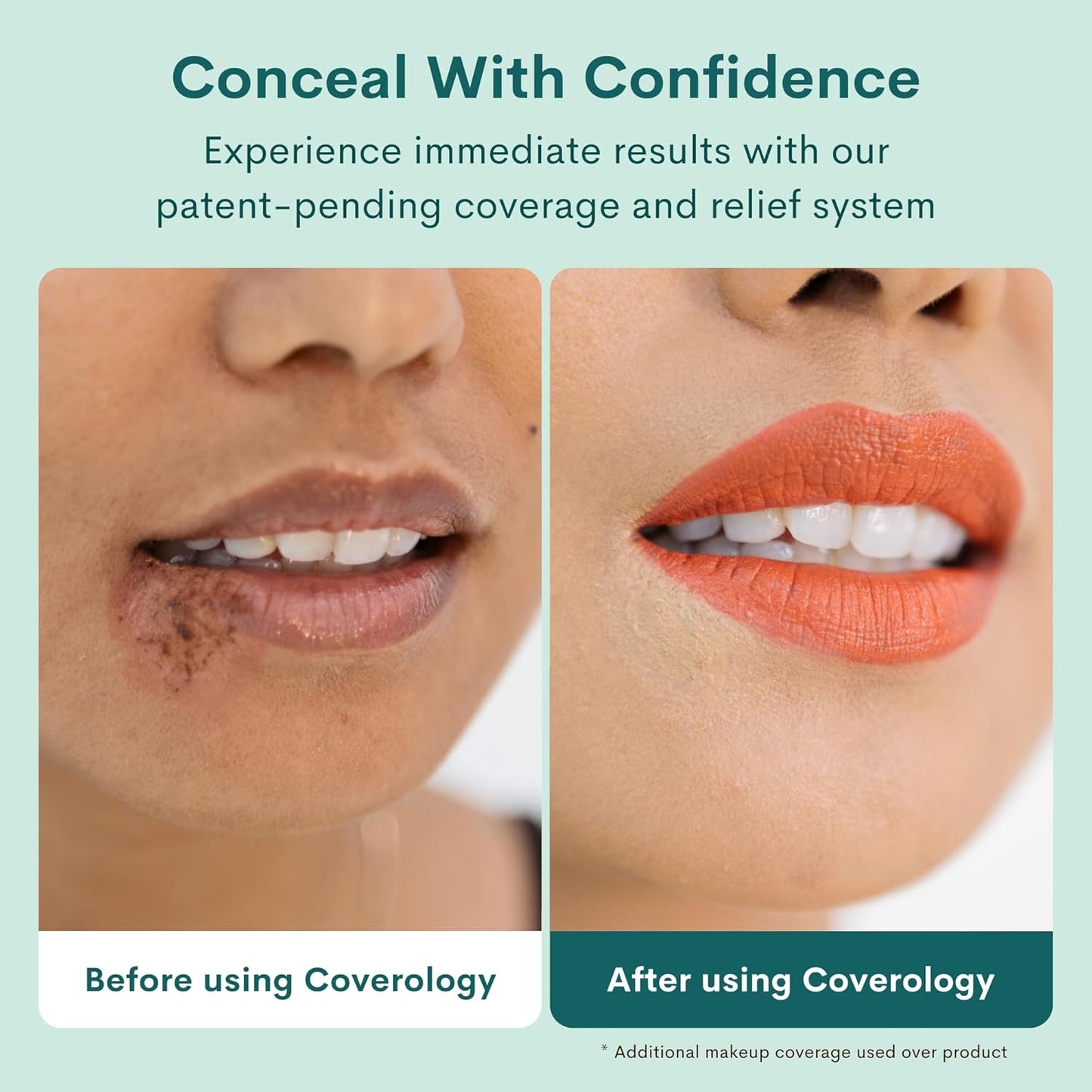 coverology-cold-sore-treatment-concealer---lightweight-full-coverage-makeup-for-soothing-disguising-cold-sores---medium-shade-5