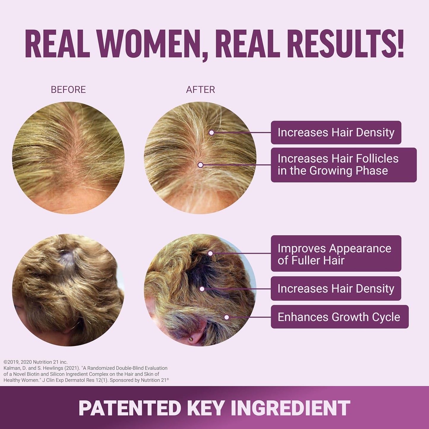 hair-growth-accelerator-soft-chews-for-women---clinically-proven-lustriva-biotin-promotes-thicker-fuller-hair---mixed-berry-60-chews-3