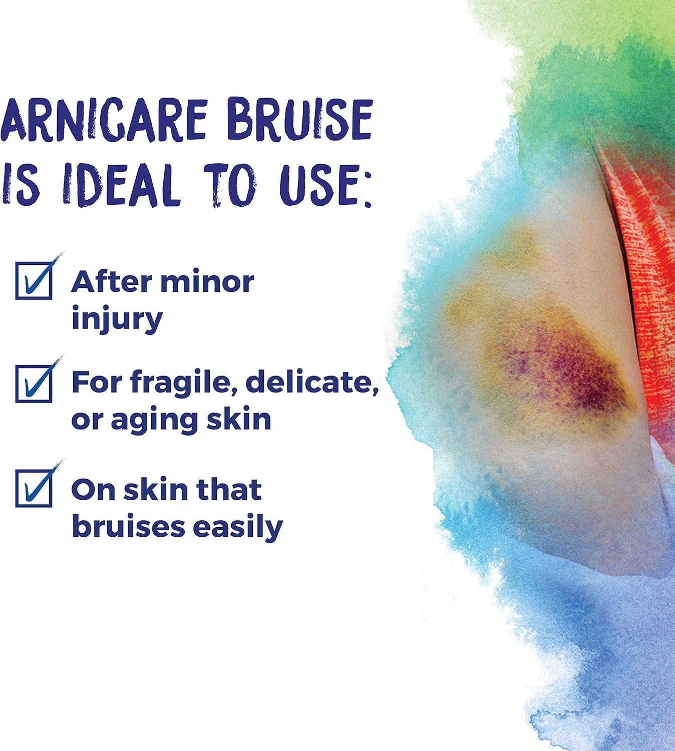 arnicare-bruise-cream-by-boiron-for-pain-relief-from-bruising-and-swelling---14-oz-1-pack---fast-healing-formula-2