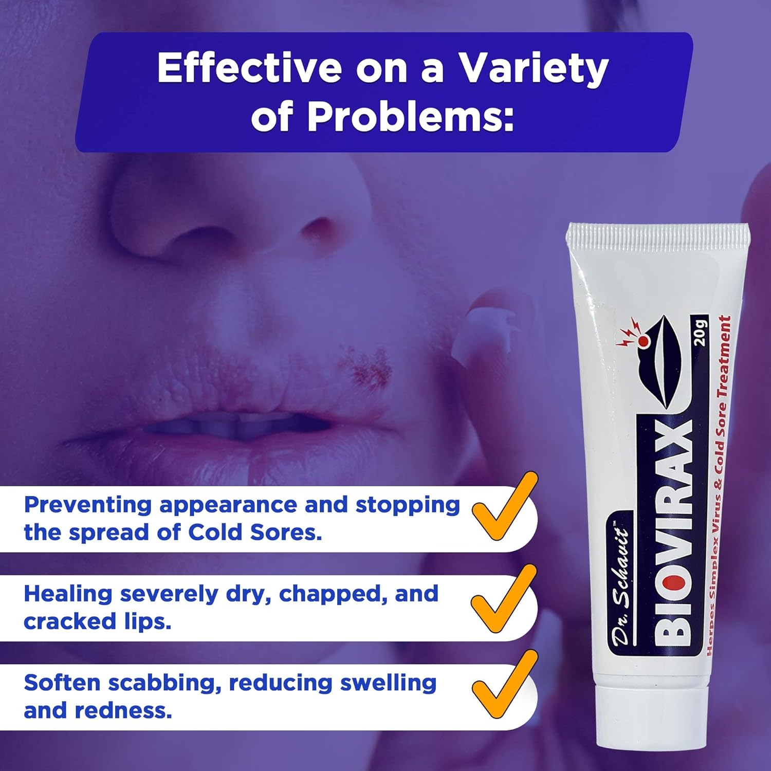 biovirax-cold-sore-treatment-cream---dr-schavit-natural-healing-for-cold-sores-prevents-spread---easy-20mg-home-remedy-4