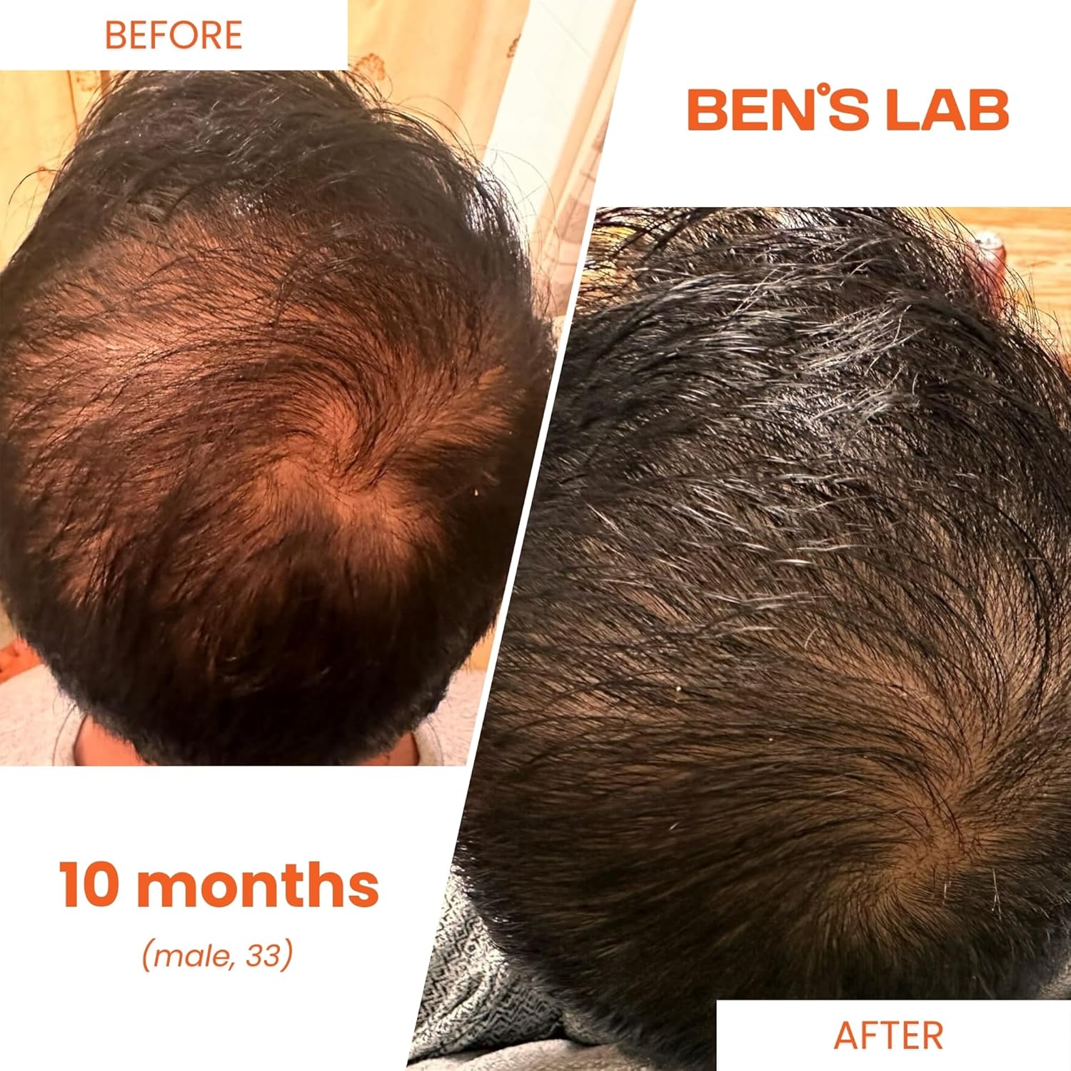 Advanced Korean Scalp Care Supplements for Thinning Hair | Promotes Hair Growth & Thickness | 60 Tablets | 1 Month Supply