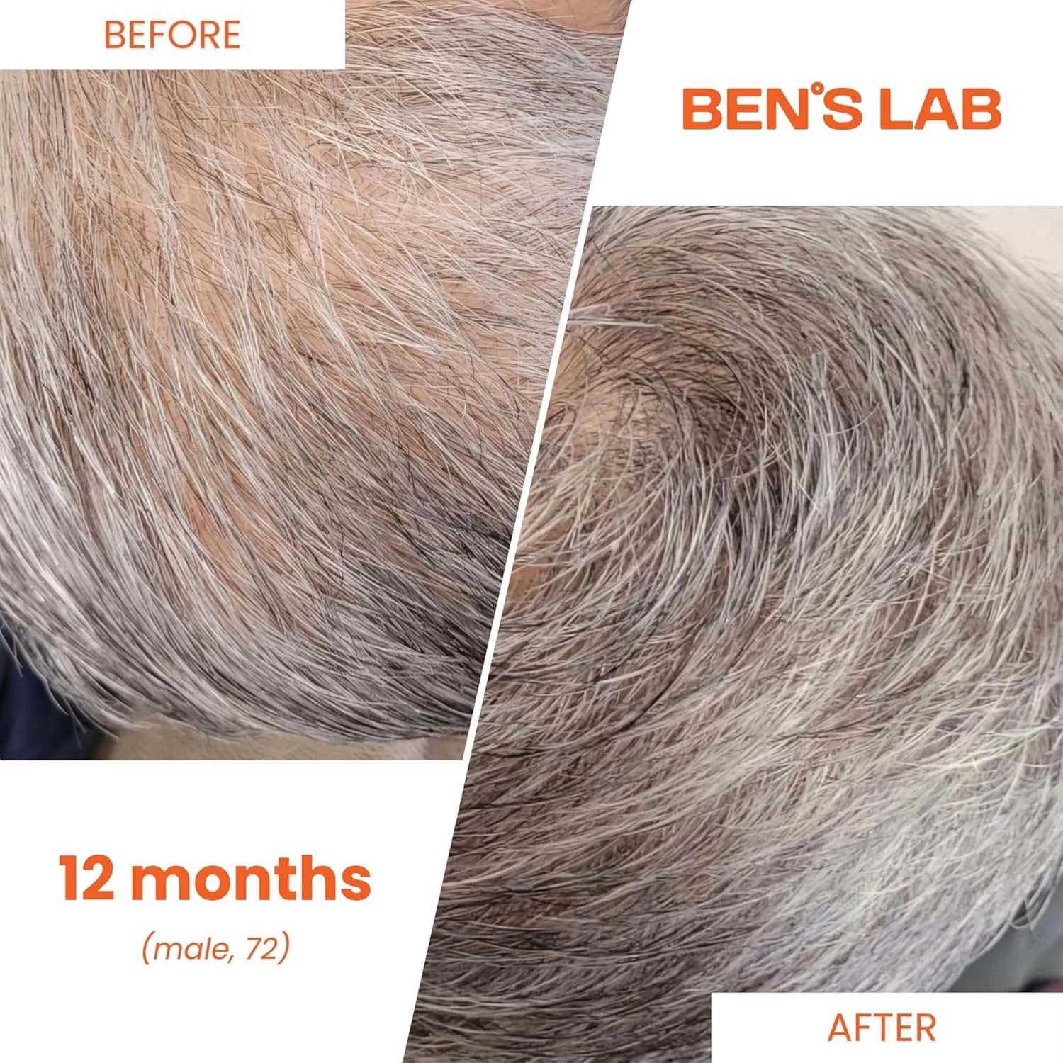 Advanced Korean Scalp Care Supplements for Thinning Hair | Promotes Hair Growth & Thickness | 60 Tablets | 1 Month Supply