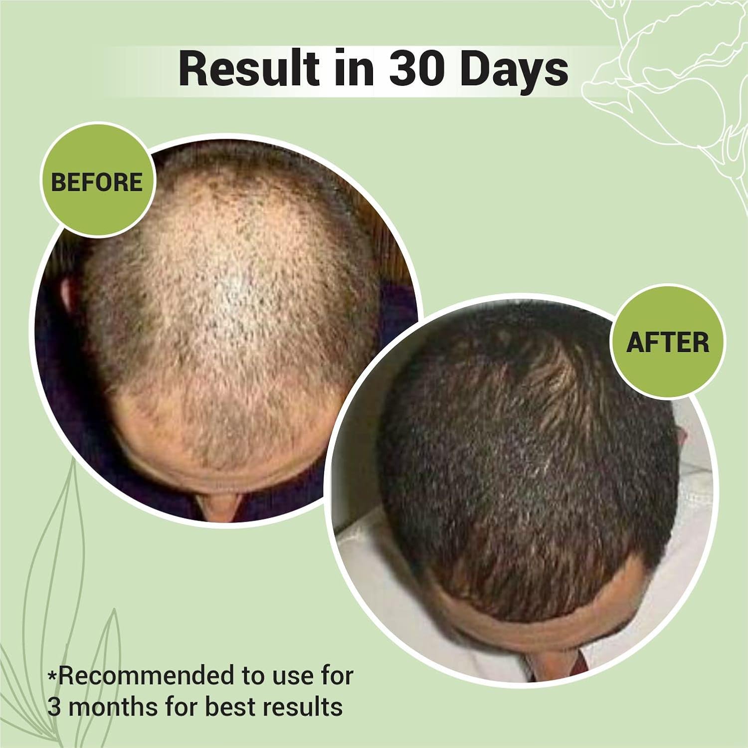 Cureveda Plant Based Biotin Powder Supplement for Hair Growth 10000 Mcg - Natural Pomegranate Flavour (1 Pack)