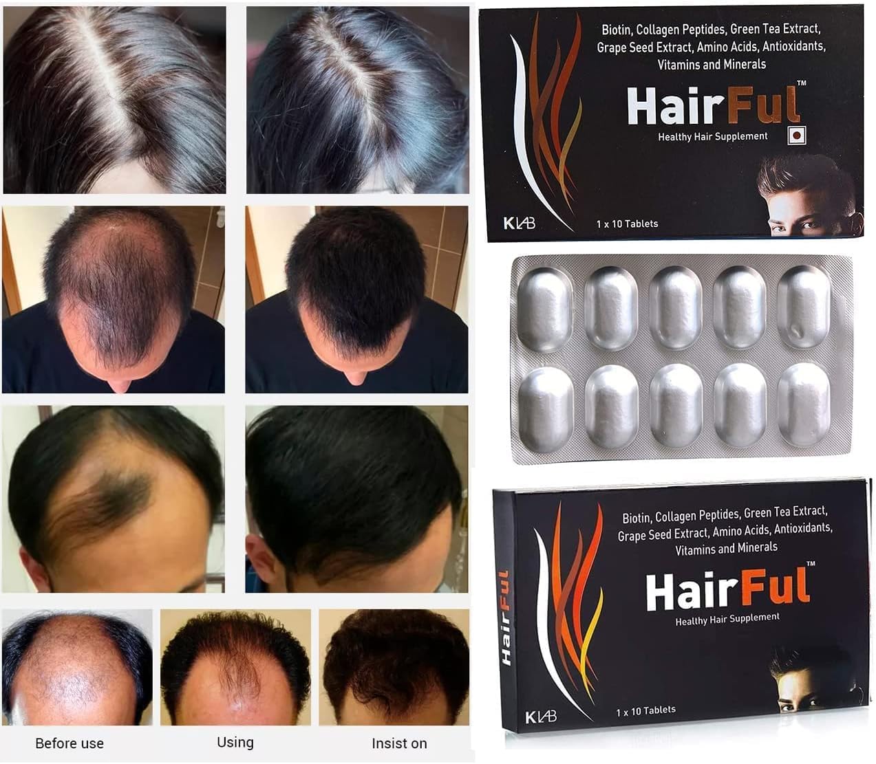 HairFul Biotin Supplement - 60 Tablets with Zero Side Effects from Pharmacylife