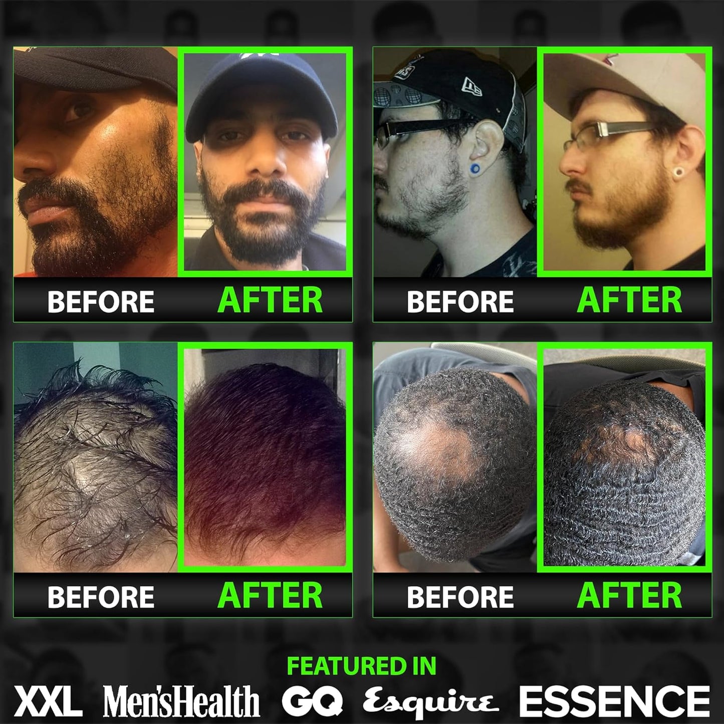 Men's Beard Growth Kit with Biotin Shampoo, Growth Vitamins, and Liquid Collagen Peptides - Promotes Hair Growth