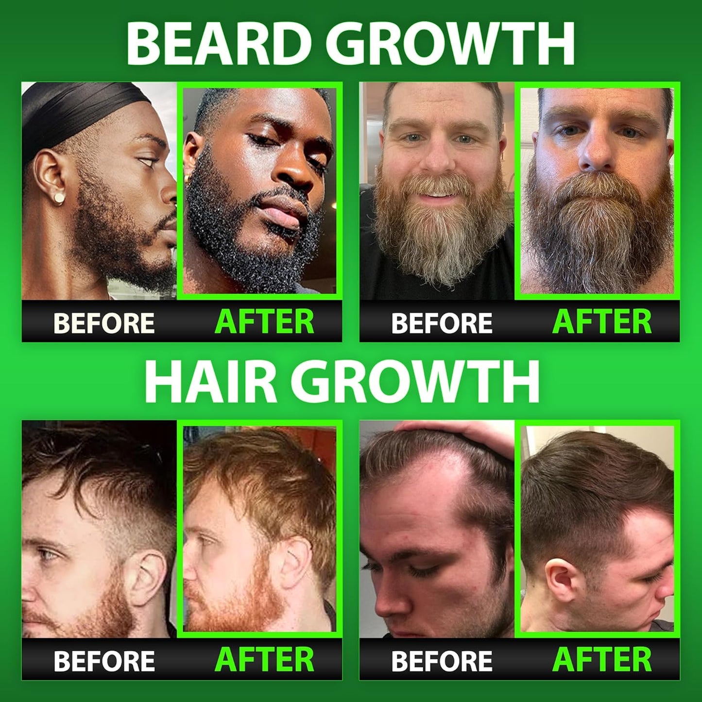 Men's Beard Growth Kit with Biotin Shampoo, Growth Vitamins, and Liquid Collagen Peptides - Promotes Hair Growth