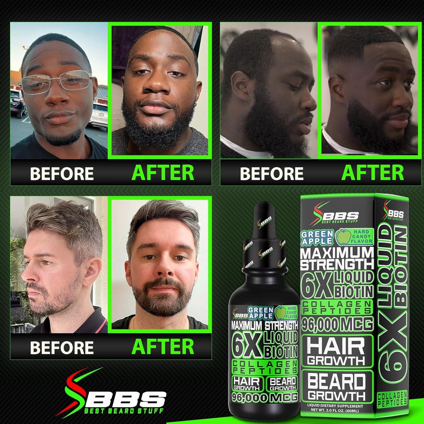 Men's Beard Growth Kit with Biotin Shampoo, Growth Vitamins, and Liquid Collagen Peptides - Promotes Hair Growth