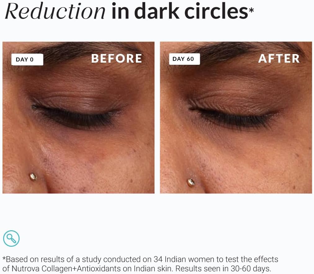 NUTROVA Collagen and Antioxidants Supplement for Skin Health and Aging Defense