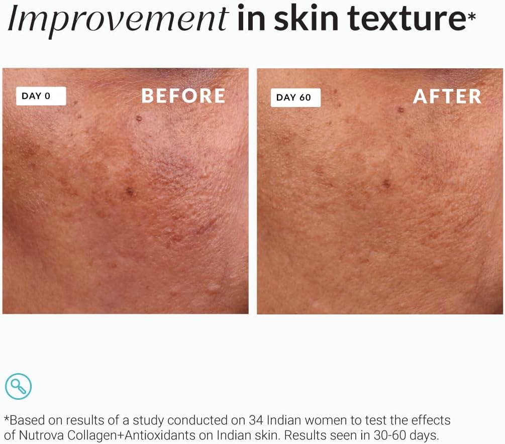NUTROVA Collagen and Antioxidants Supplement for Skin Health and Aging Defense