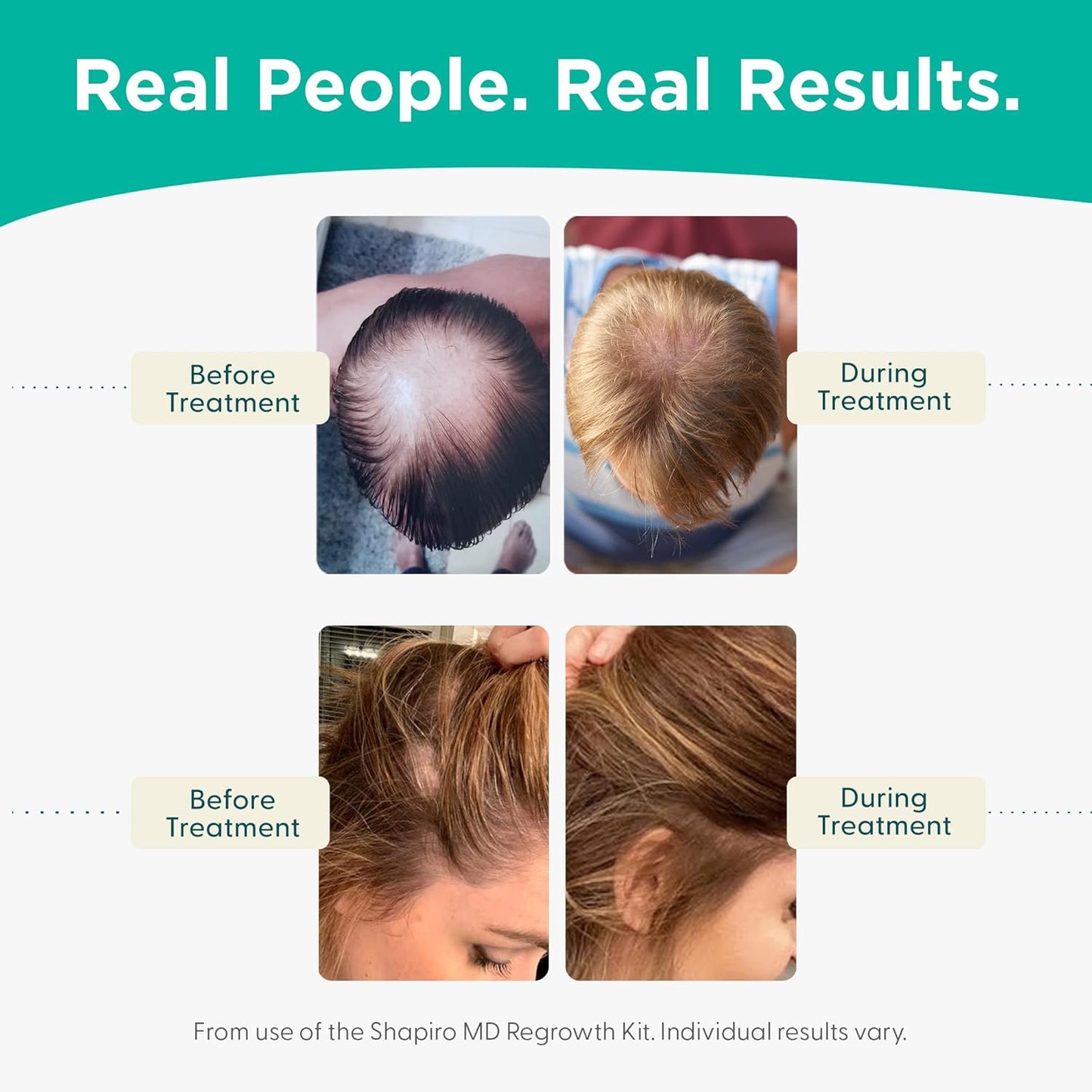 Shapiro MD Hair Growth Trio: Collagen Powder, Daily Vitamin, Prebiotic Formula for Full, Strong, Healthy Hair | Recommended by Dermatologist