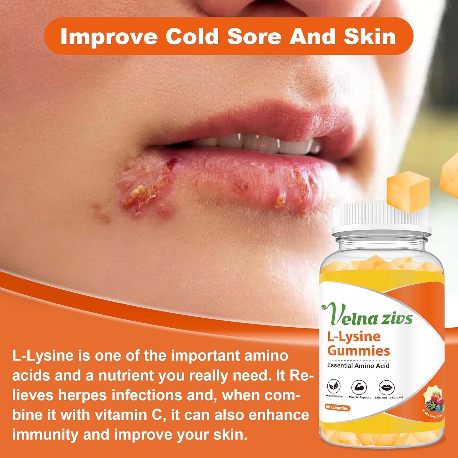 1000mg Velna Fish L-Lysine Gummies for Lips & Skin Health, Cold Sore Support, Immune Boost - 60 Count Vegan Chewable Supplement