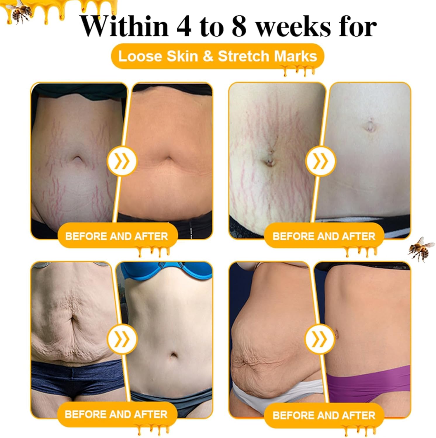 4 Boxes of Diapason Bee Venom Feminine Repair Tighten Detox Yoni Capsules - Firming & Natural Pink and Tender Capsules