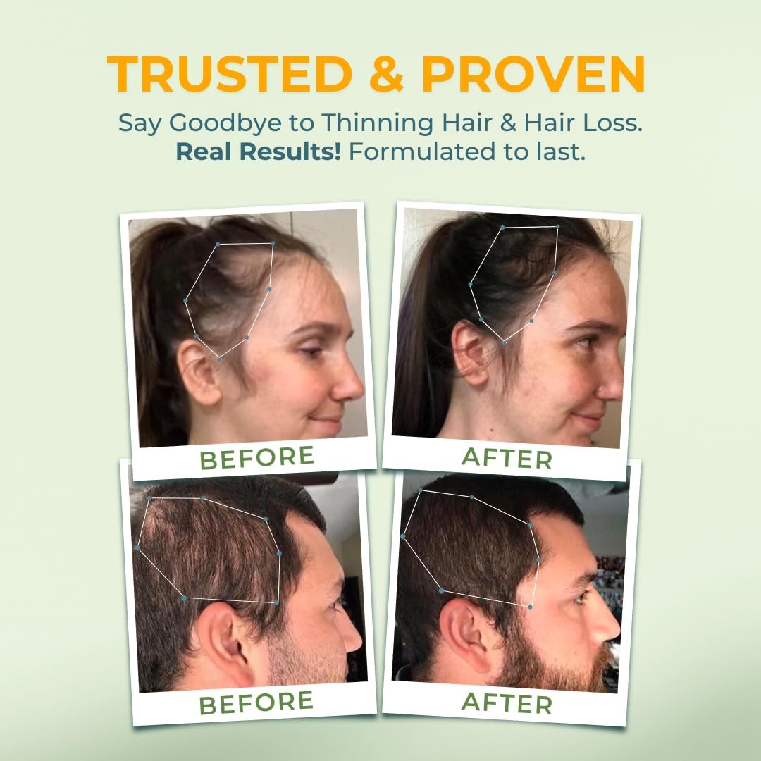 hair-growth-vitamins-with-biotin-vitamin-b-for-men-women---supports-healthy-hair-skin-nails---hormone-free-gluten-free-hair-supplement-7