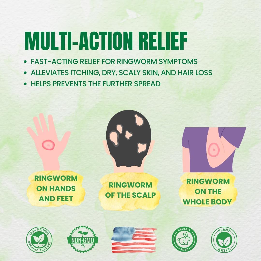 organic-homeopathic-ringworm-treatment-for-humans-037-fl-oz---antifungal-relief-for-itchy-red-skin---non-gmo-2