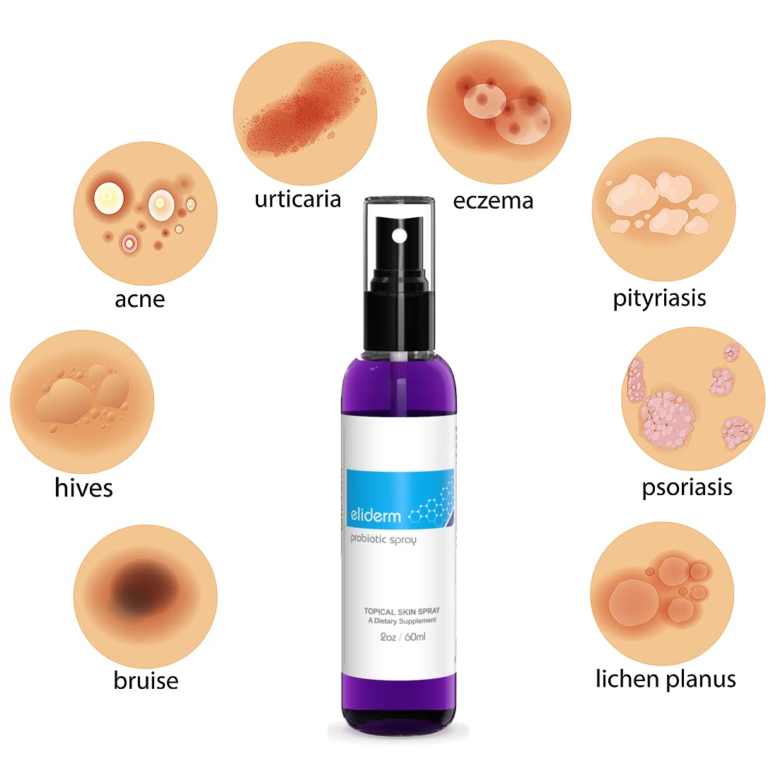 omnutra-skin-probiotic-spray---13-live-strains-for-acne-folliculitis-dermatitis-rosacea-eczema---body-face-mist-deodorant---microbiome-care-2