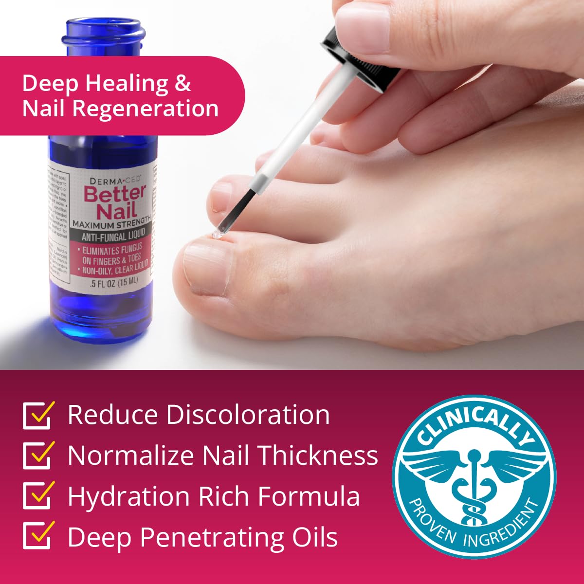 maximum-strength-anti-fungal-solution-for-nail-support---better-nail-treatment-for-fungus-under-around-the-nail---nail-restoring-formula-6