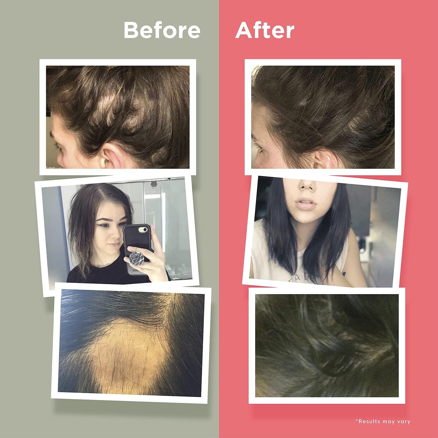 hairanew-hair-growth-vitamins-for-thicker-stronger-hair---men-women---all-hair-types---11-vitamins-ingredients---5000mcg-biotin---vegan---independently-tested---60-capsules-5