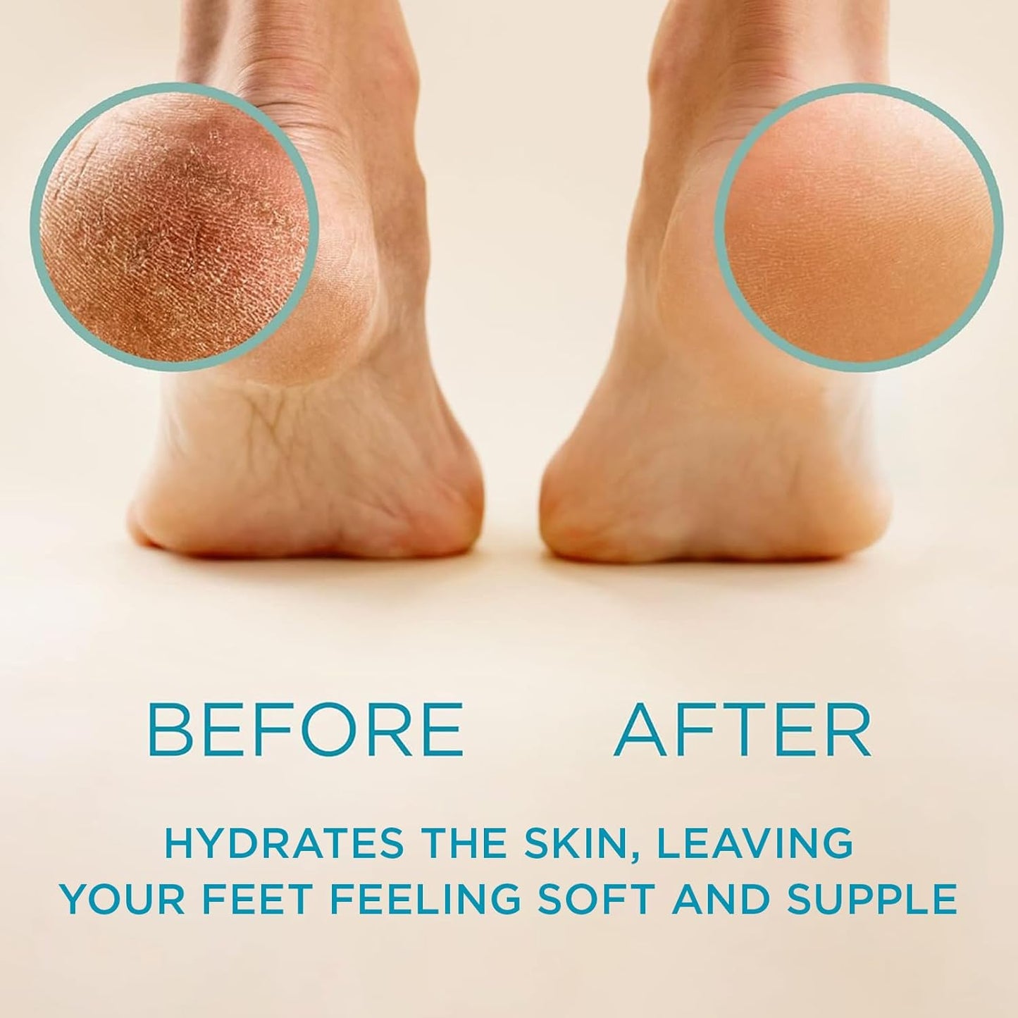 Lee Beauty Professional Callus Remover Gel - Extra Strength Formula for Home Pedicure Results - 8 Oz Bottle for Cracked & Dry Feet - Espot.com.au