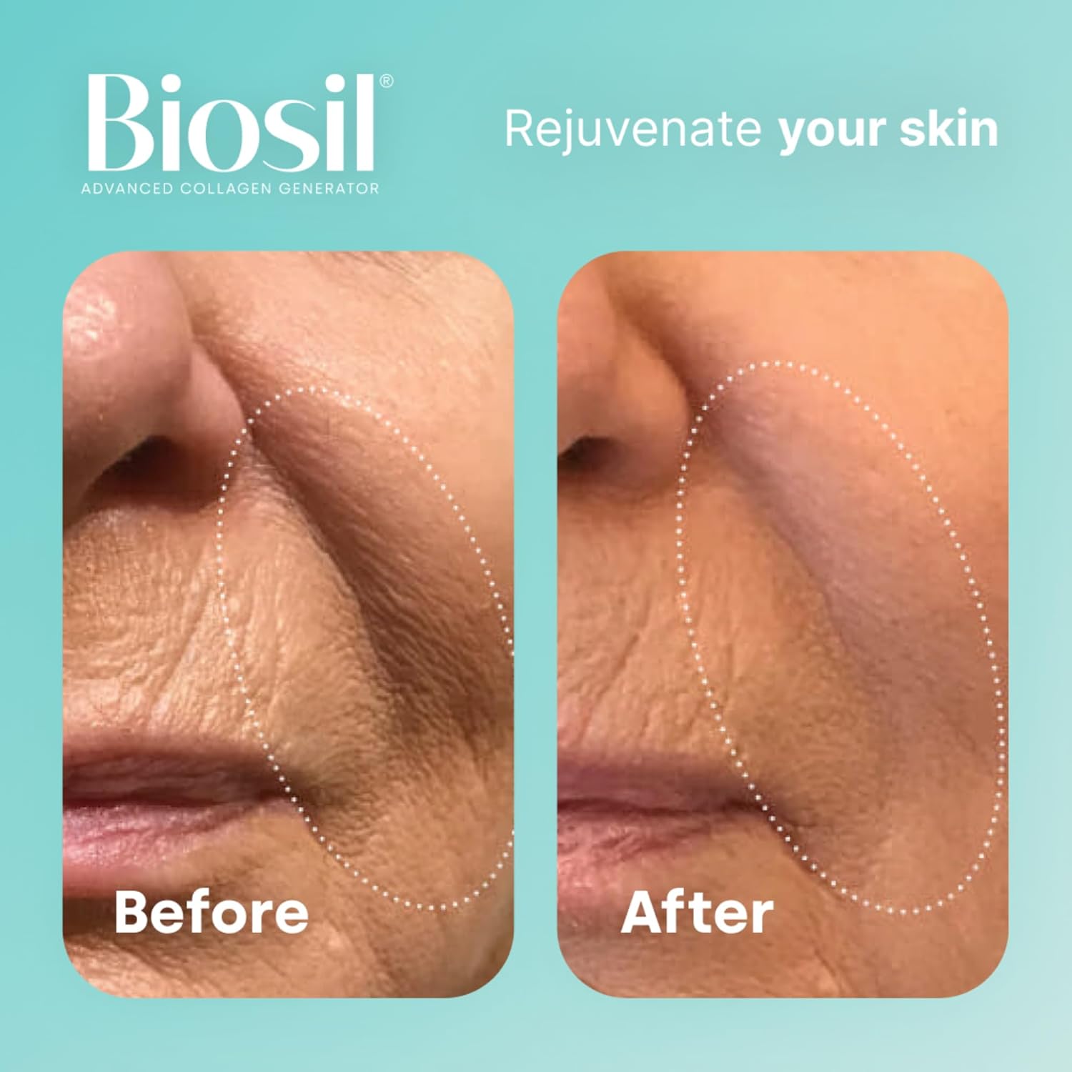 biosil-collagen-generator-drops---1-fl-oz---patented-ch-osa-complex---boosts-collagen-production---non-gmo---60-day-supply-5