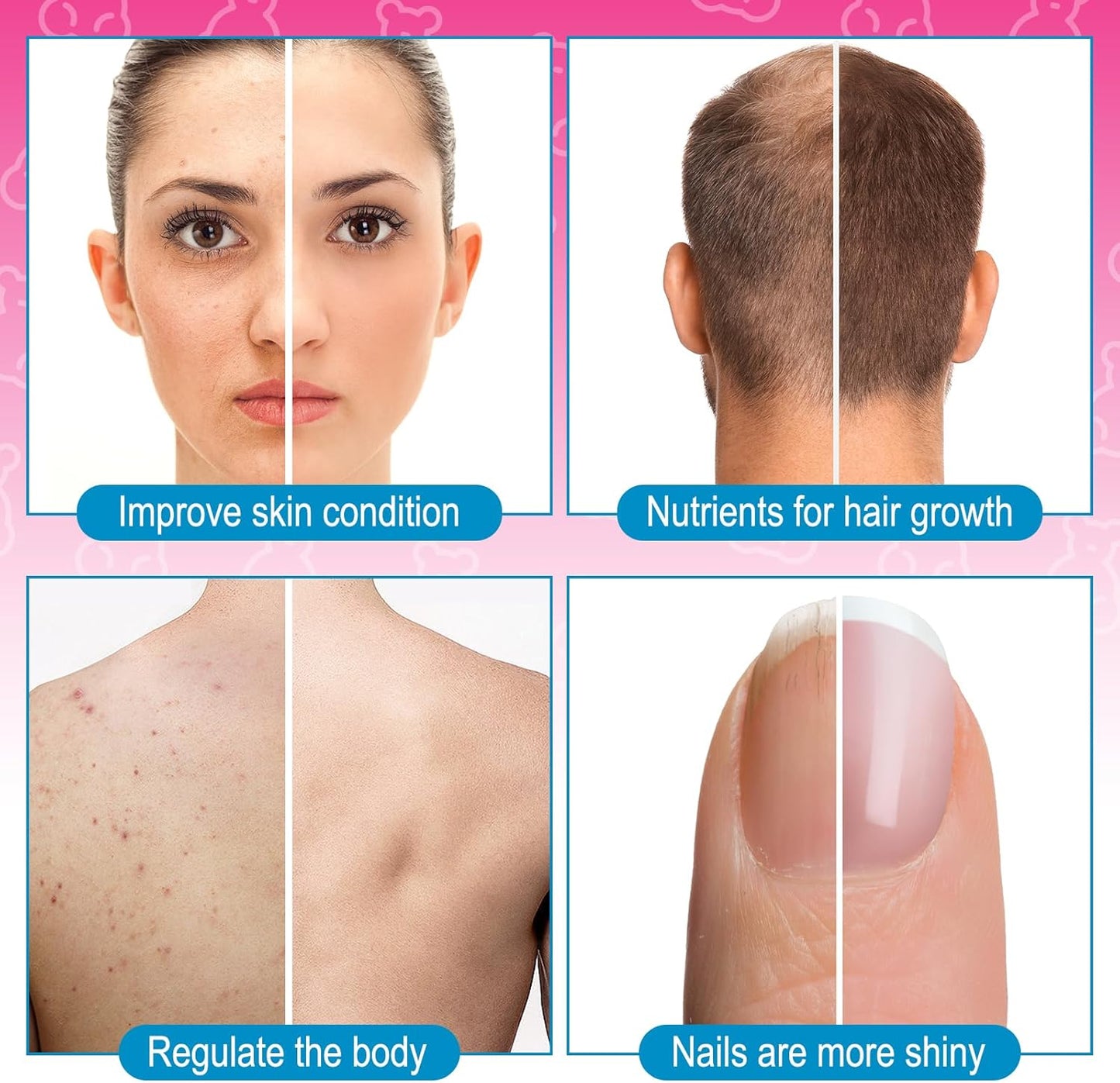 chewable-biotin-gummies-for-hair-growth-nails---vitamins-with-coconut-oil---10000-mcg-hair-supplement-for-loss-skin-7