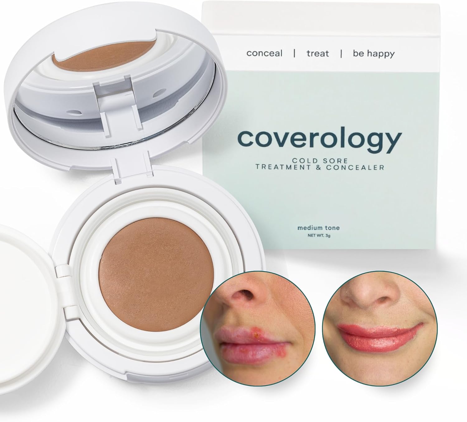 coverology-cold-sore-treatment-concealer---lightweight-full-coverage-makeup-for-soothing-disguising-cold-sores---medium-shade-1