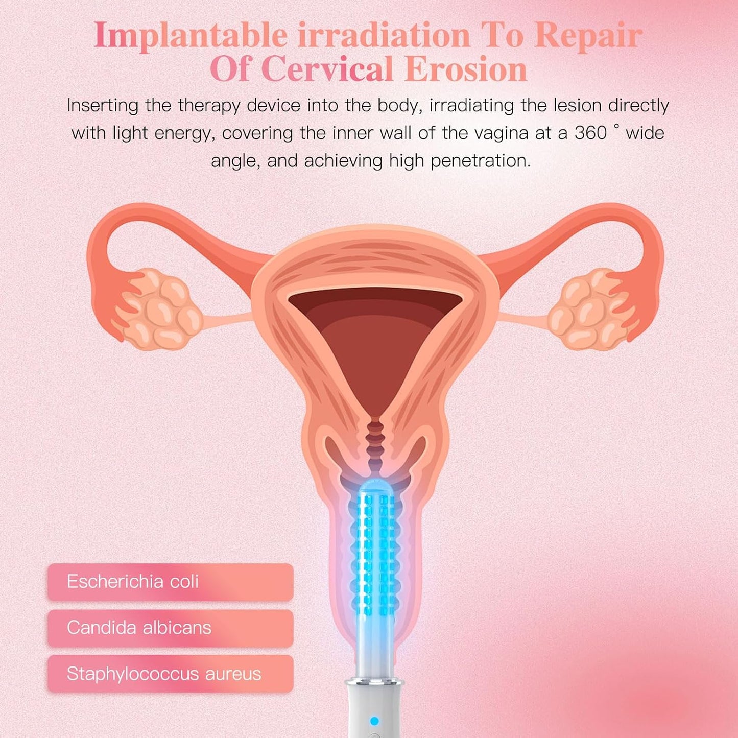 vaginal-rejuvenation-wand-with-red-blue-light-therapy-for-women---gynecological-device-for-ph-balance-and-health-5