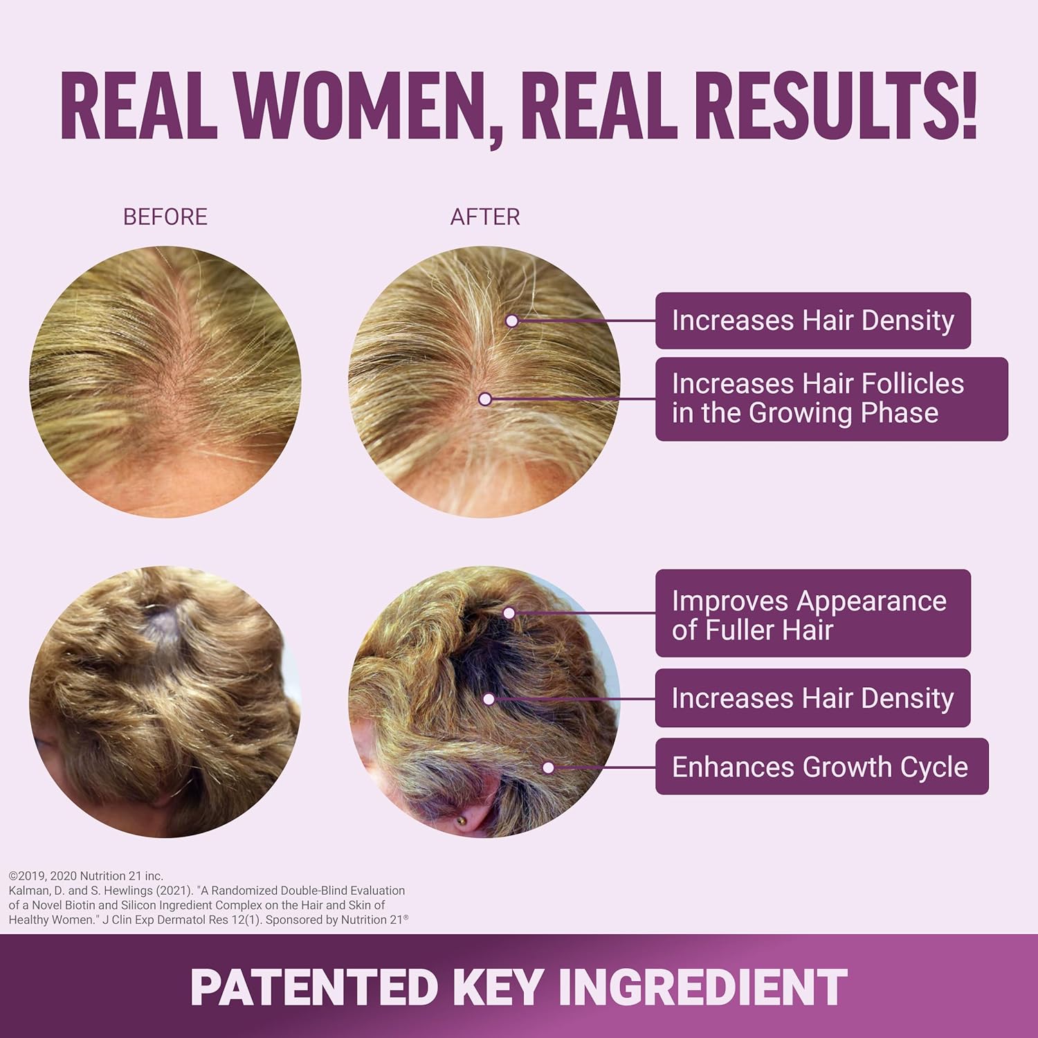 hair-growth-accelerator-soft-chews-for-women---clinically-proven-lustriva-biotin-promotes-thicker-fuller-hair---mixed-berry-60-chews-3