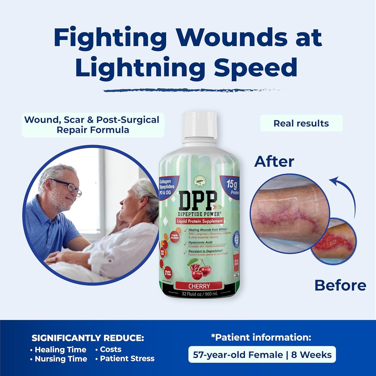 cherry-flavored-liquid-collagen-whey-protein-supplement-for-wound-healing-healthy-skin---dpp-dipeptide-formula-sugar-free---32-fl-oz-bottle-8