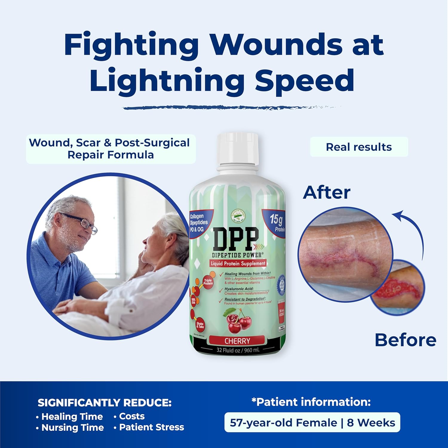 cherry-flavored-liquid-collagen-whey-protein-supplement-for-wound-healing-healthy-skin---dpp-dipeptide-formula-sugar-free---32-fl-oz-bottle-8