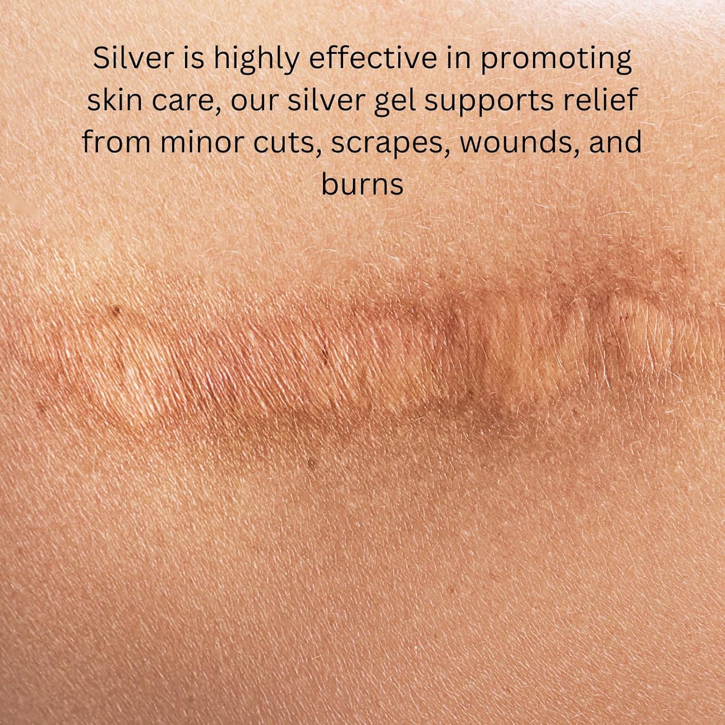 ameo-life-colloidal-silver-gel-35-ppm---ph-balanced-structured-silver-gel-for-skin-health---natural-care-for-cuts-scrapes-burns-100ml-5