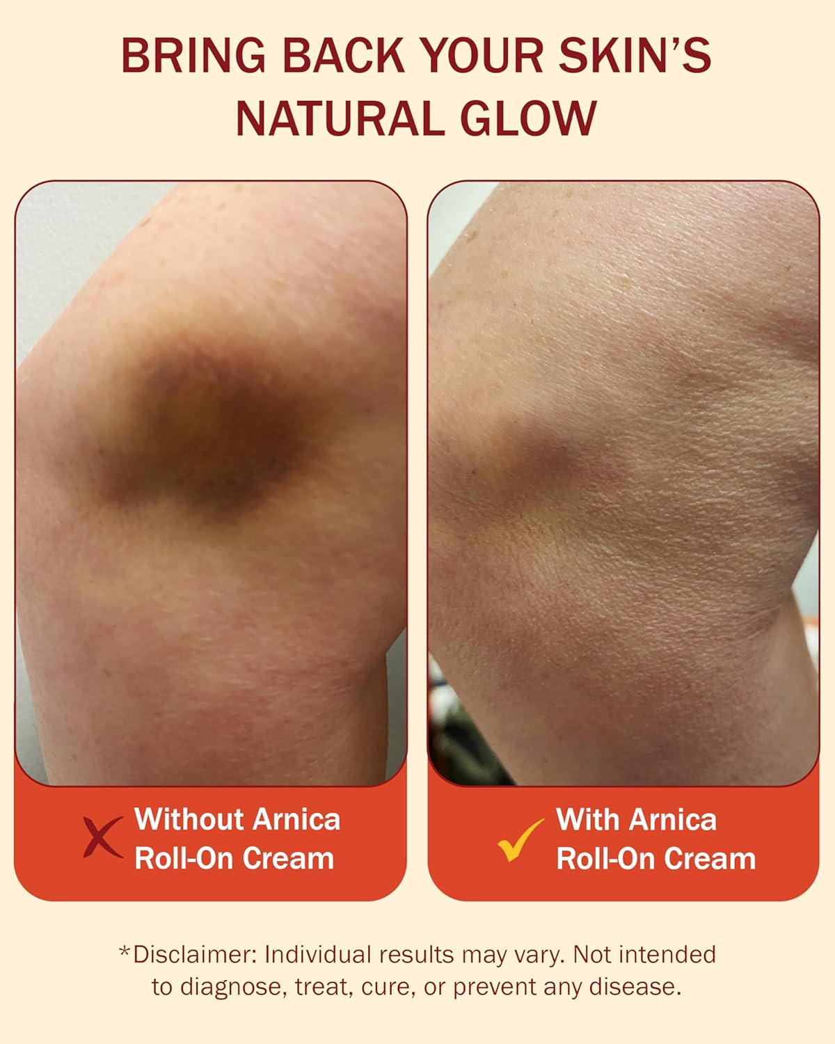 arnica-cream-with-vitamin-k---soothes-muscles-joints-reduces-bruising---4-fl-oz-5