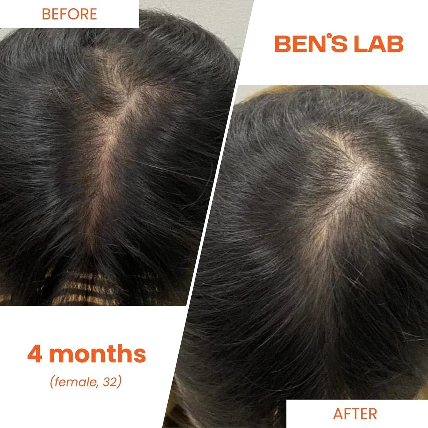 Advanced Korean Scalp Care Supplements for Thinning Hair | Promotes Hair Growth & Thickness | 60 Tablets | 1 Month Supply