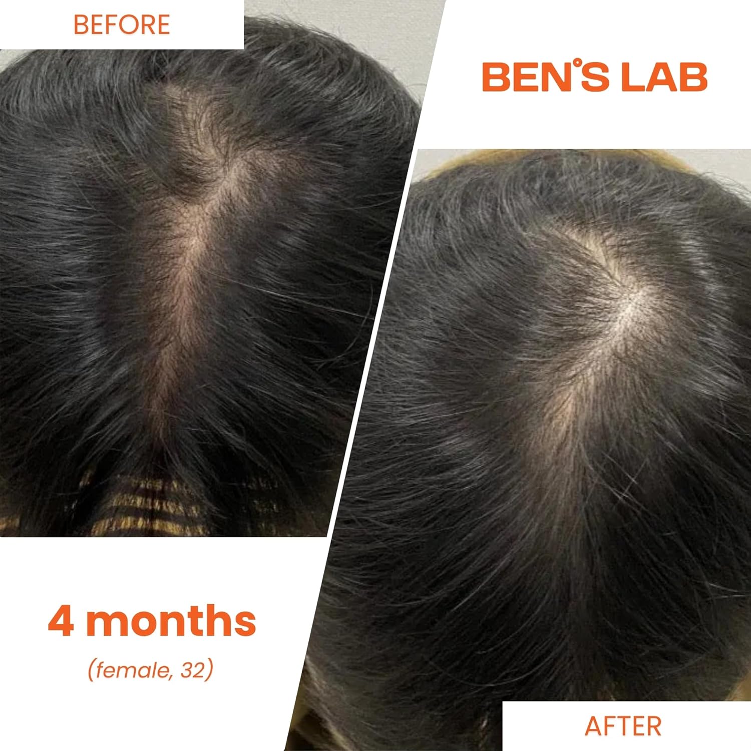 Advanced Korean Scalp Care Supplements for Thinning Hair | Promotes Hair Growth & Thickness | 60 Tablets | 1 Month Supply