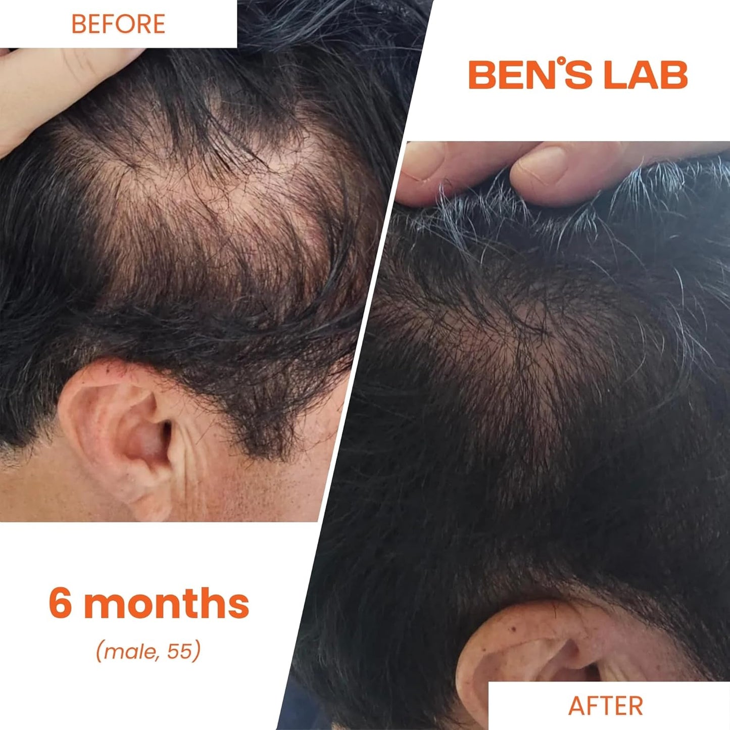 Advanced Korean Scalp Care Supplements for Thinning Hair | Promotes Hair Growth & Thickness | 60 Tablets | 1 Month Supply