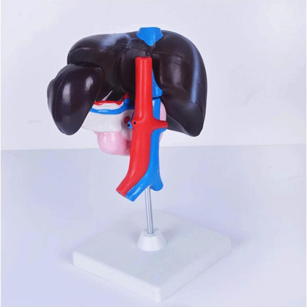 Detachable Human Liver, Pancreas, and Duodenum Model for Medical Study Tools