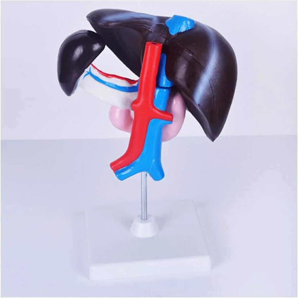 Detachable Human Liver, Pancreas, and Duodenum Model for Medical Study Tools