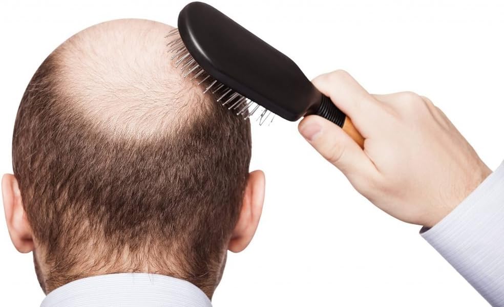 Hair Growth Support Vitamins with DHT Blocking Formula for Men - Enhanced with He Shou Wu Extract and Biotin - Advanced Trichology Support - 120 Tablets