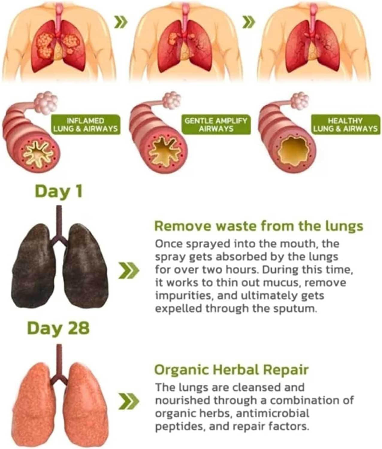 Herbal Lung Cleanse Spray - Natural Breath Detox & Lung Support (5 Pack)