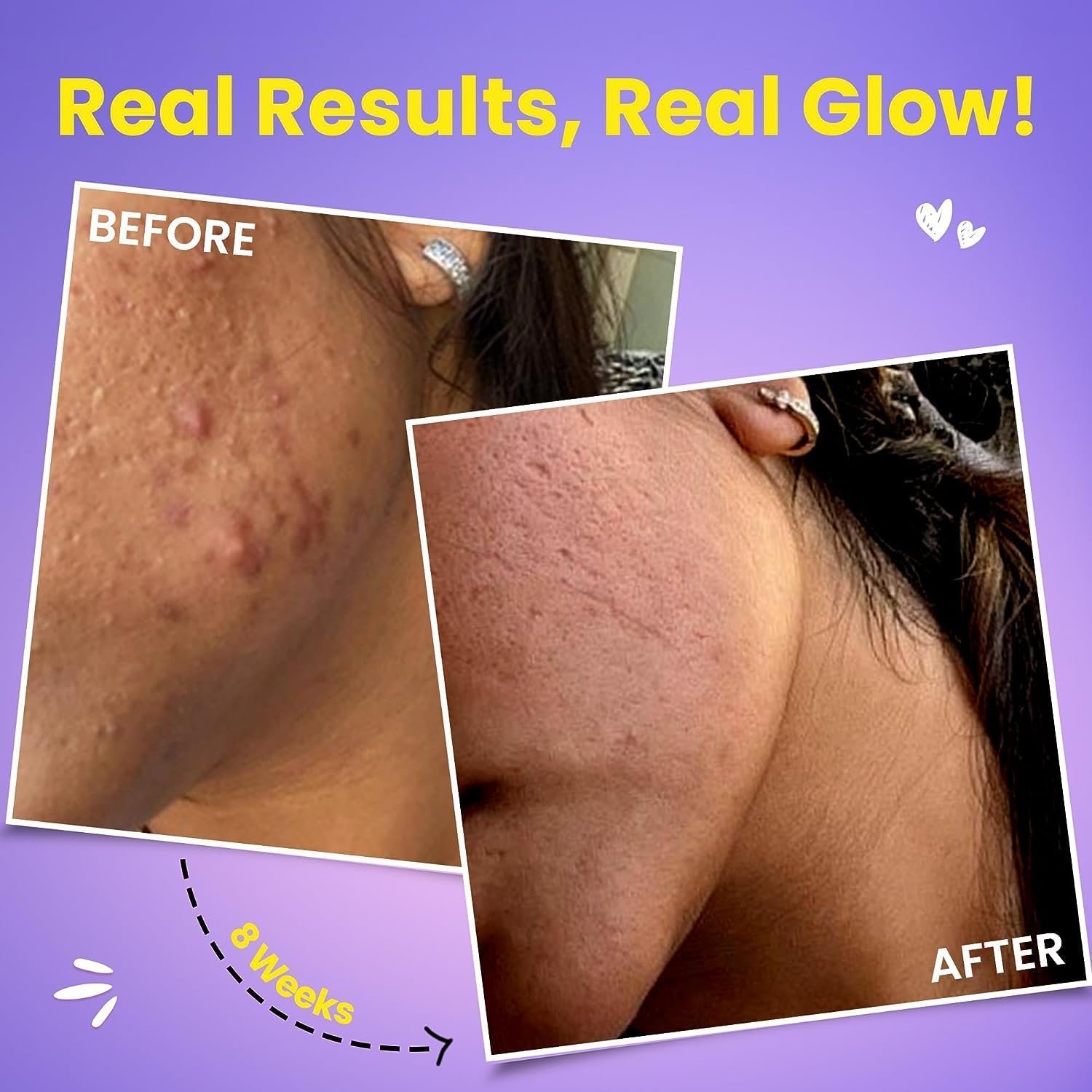 Japanese Glutathione 500mg and Vitamin C Tablets for Glowing Skin - Strawberry-Lemon Flavor - 20 Effervescent Tabs