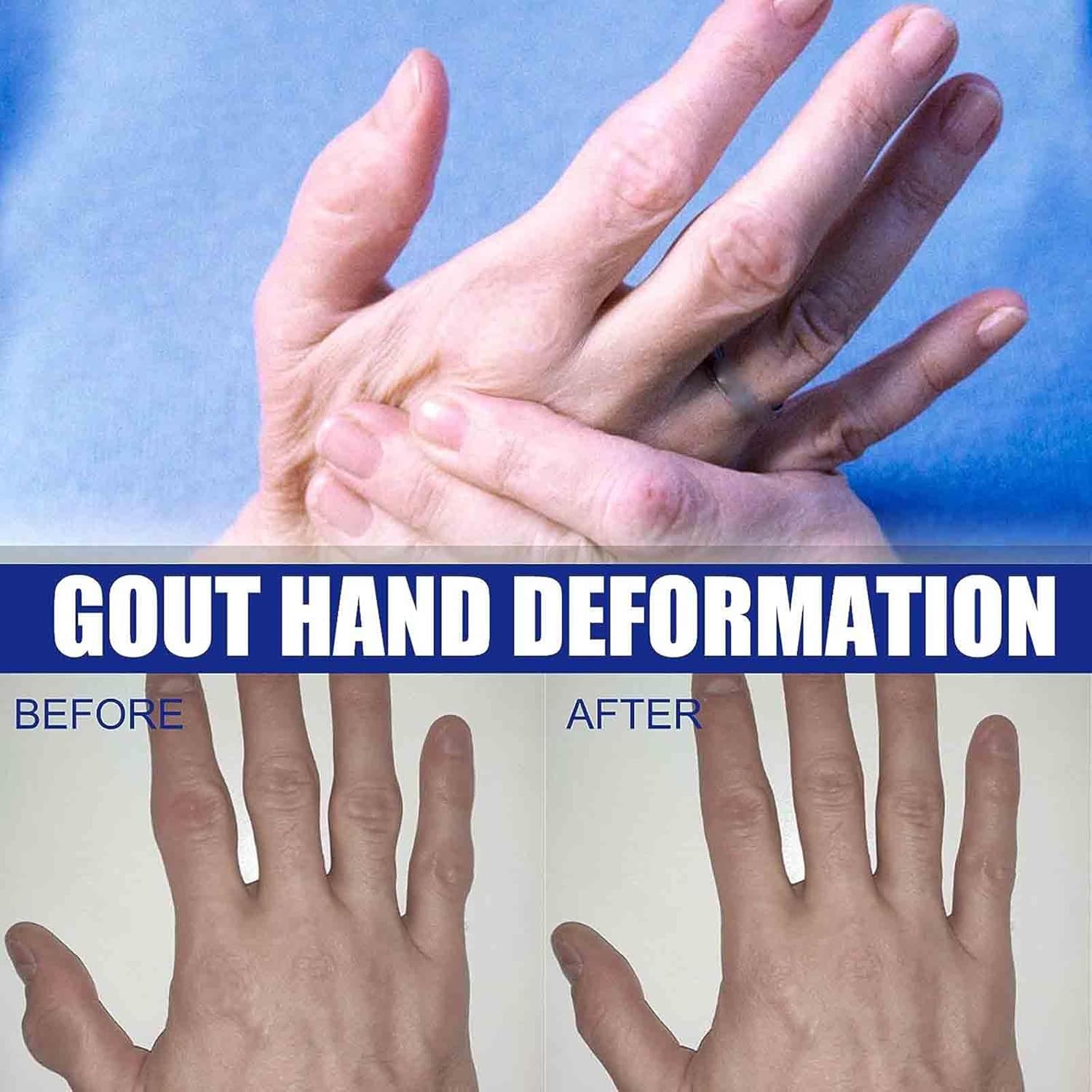 Kidney Care Herbal Drops for Strong and Relaxing Kidneys - Oral Solution (2pcs)