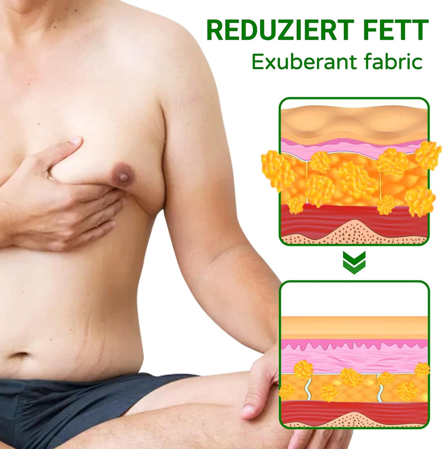 Men's Gynecomastia Compression Patch - Ginger Cream for Sculpting Chest Muscles Naturally - 1 Pack
