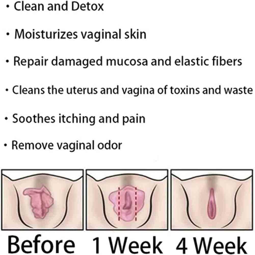 Natural Instant Anti-Itch Detox Slimming Products - Viginal Capsules & Gel (8 Bags)