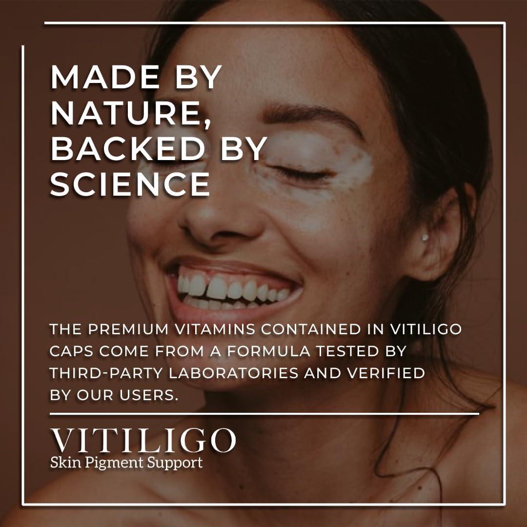 Natural Vitiligo Supplement Capsules | Reduce White Spots, Improve Skin Pigmentation | Dermawonder Vitiligo Support | 60 Count, All Skin Types