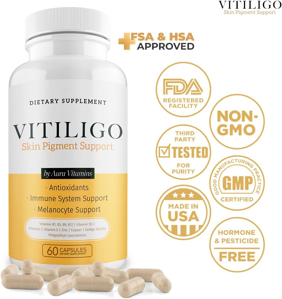 Natural Vitiligo Supplement Capsules | Reduce White Spots, Improve Skin Pigmentation | Dermawonder Vitiligo Support | 60 Count, All Skin Types